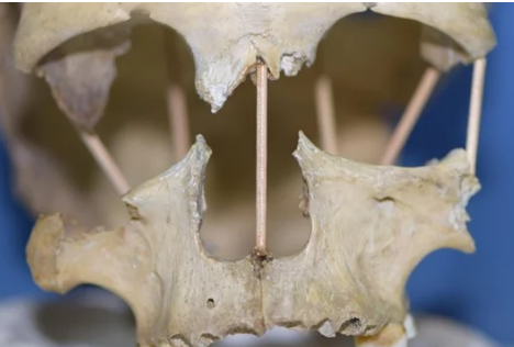 研究人員成功測序了35,000年的頭骨