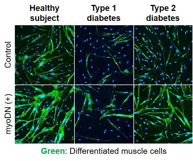 寡核苷酸DNA改善了糖尿病加劇的骨骼肌丟失