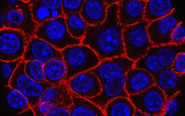 研究人員指出乳腺癌細胞的層次結構是治療耐藥的潛在原因