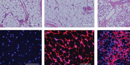 移植的類似褐脂的細胞有望肥胖和糖尿病