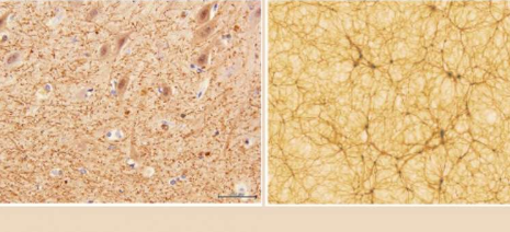人類的大腦類似于宇宙嗎