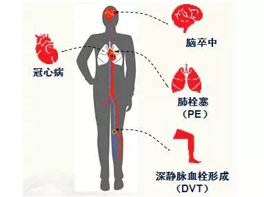 研究人員將使用數(shù)字技術(shù)幫助應(yīng)對(duì)慢性病