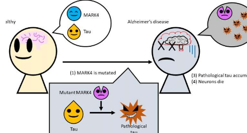 阿爾茨海默氏病的原因可追溯到常見酶的突變