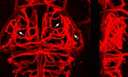 在發(fā)育過程中發(fā)現(xiàn)腦血管尋路的機(jī)制