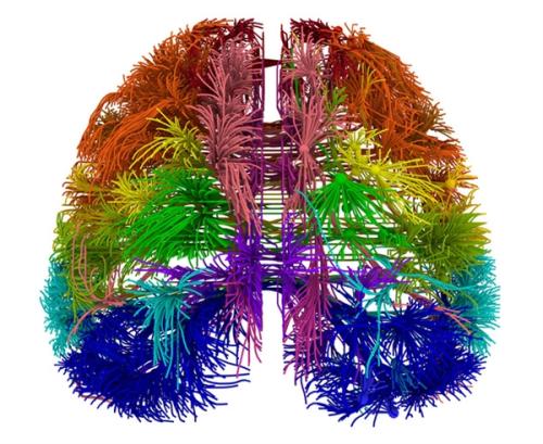 研究發(fā)現(xiàn)新基因可能推動(dòng)最早的大腦改變