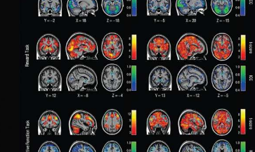 關(guān)于大腦活動的研究沒有科學(xué)家認(rèn)為的有用