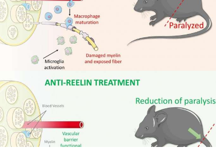 研究人員發(fā)現(xiàn)有希望的多發(fā)性硬化癥新治療方法