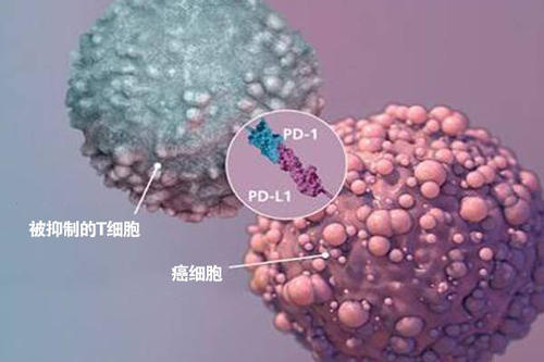 針對髓樣細胞的新型癌癥免疫療法可以減緩腫瘤生長