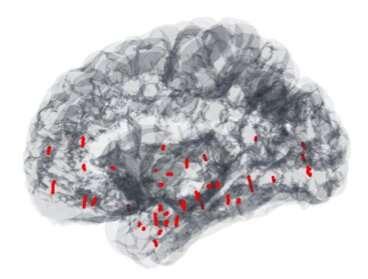 研究探索了正念冥想和催眠的神經(jīng)動(dòng)力學(xué)