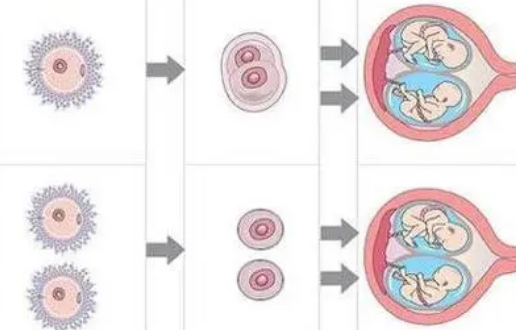 為什么免疫缺陷只影響一個(gè)同卵雙胞胎
