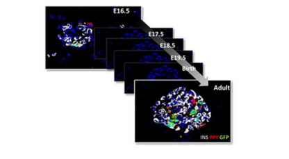 研究人員對胰腺內(nèi)分泌細胞起源的新見解