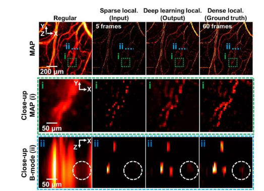 人工智能技術(shù)加速血管超分辨率定位光聲成像
