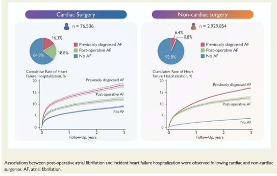 手術(shù)后心房顫動與心力衰竭住院風(fēng)險增加有關(guān)