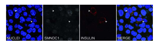 SMNDC1缺失誘導(dǎo)α細胞產(chǎn)生胰島素