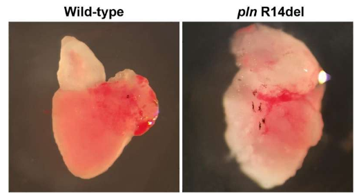 第一個致心律失常性心肌病患者特異性斑馬魚模型