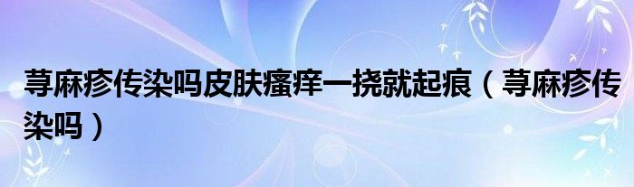 蕁麻疹傳染嗎皮膚瘙癢一撓就起痕（蕁麻疹傳染嗎）