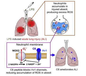 研究人員確定了預(yù)防 ARDS 的新治療方法
