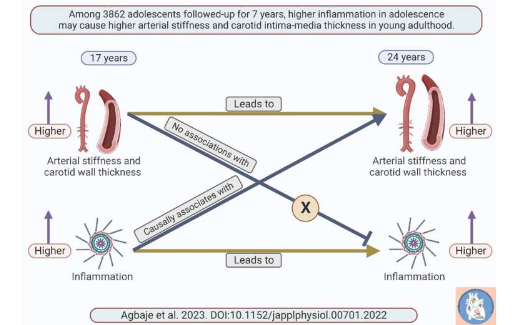 低度炎癥可能導致其他方面健康的青少年動脈僵硬和臨床前動脈粥樣硬化