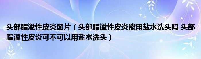 頭部脂溢性皮炎圖片（頭部脂溢性皮炎能用鹽水洗頭嗎 頭部脂溢性皮炎可不可以用鹽水洗頭）