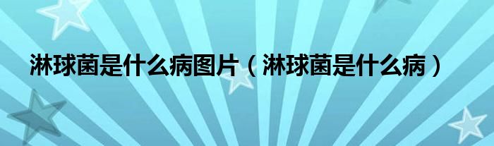 淋球菌是什么病圖片（淋球菌是什么?。?class='thumb lazy' /></a>
		    <header>
		<h2><a  href=