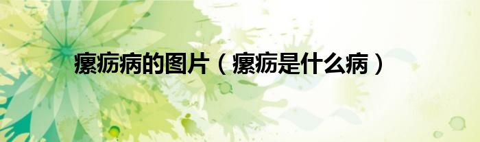 瘰疬病的圖片（瘰疬是什么?。?class='thumb lazy' /></a>
		    <header>
		<h2><a  href=