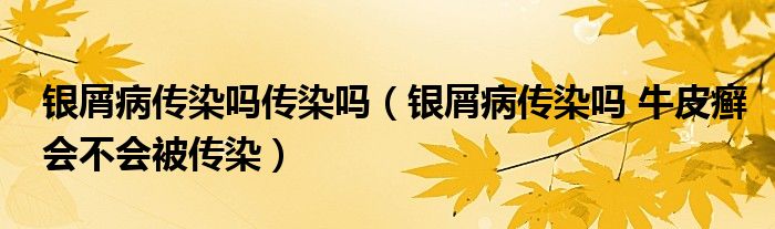 銀屑病傳染嗎傳染嗎（銀屑病傳染嗎 牛皮癬會不會被傳染）