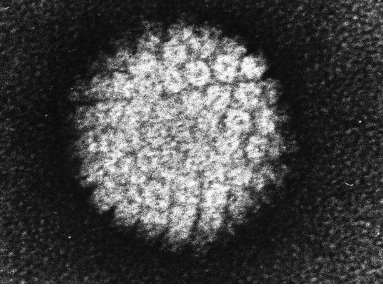 研究發(fā)現(xiàn)人們對 HPV 與宮頸癌之間聯(lián)系的認(rèn)識有所下降