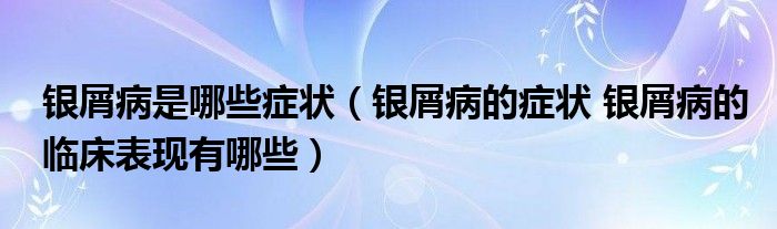 銀屑病是哪些癥狀（銀屑病的癥狀 銀屑病的臨床表現(xiàn)有哪些）