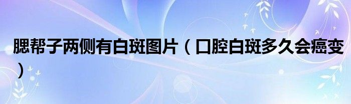 腮幫子兩側(cè)有白斑圖片（口腔白斑多久會(huì)癌變）