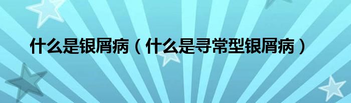 什么是銀屑?。ㄊ裁词菍こＰ豌y屑?。?class='thumb lazy' /></a>
		    <header>
		<h2><a  href=