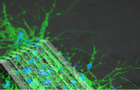 微型機器人用于在大鼠神經(jīng)細胞網(wǎng)絡之間架起橋梁