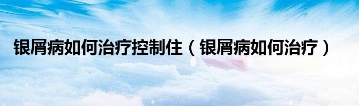 銀屑病如何治療控制?。ㄣy屑病如何治療）