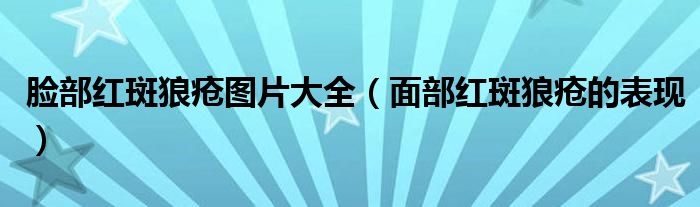 臉部紅斑狼瘡圖片大全（面部紅斑狼瘡的表現）