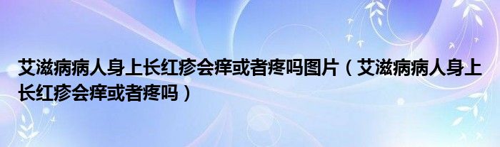 艾滋病病人身上長紅疹會(huì)癢或者疼嗎圖片（艾滋病病人身上長紅疹會(huì)癢或者疼嗎）