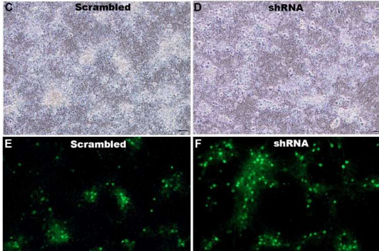 RNA 治療有望增強記憶力并減輕焦慮