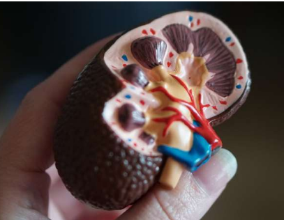 人工胰腺對接受腎透析的 1 型糖尿病患者有希望