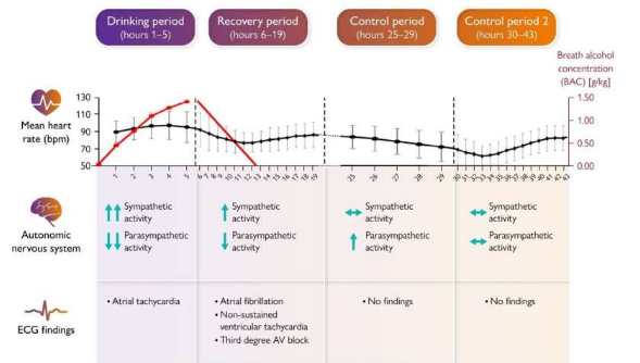 心電圖監(jiān)測研究發(fā)現(xiàn)過量飲酒后心律失常