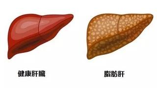 母乳喂養(yǎng)超過六個(gè)月的母親 發(fā)生脂肪肝的可能性降低