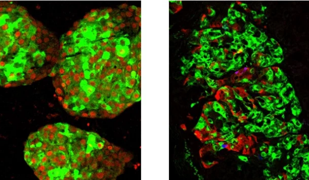 在實驗室中生長的功能性胰島素產(chǎn)生細(xì)胞