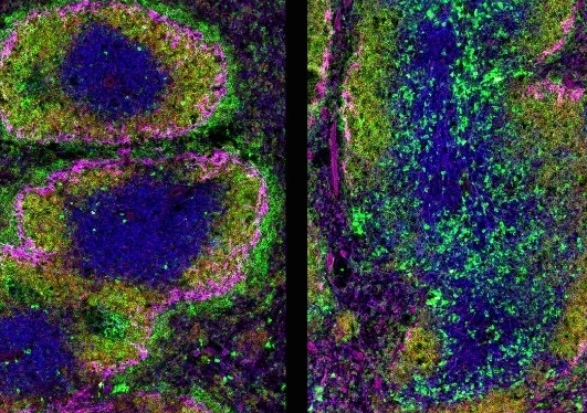 科學家展示蛋白質Ikaros如何協(xié)調精細平衡以控制自身免疫