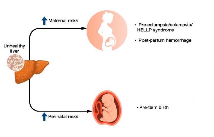 懷孕后的NAFLD會(huì)增加母親和嬰兒的風(fēng)險(xiǎn)
