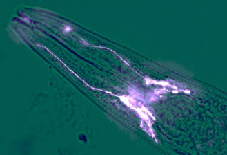 蠕蟲研究表明腦細(xì)胞可以阻止肌肉萎縮