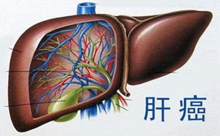 先天免疫傳感器的新作用抑制肝癌